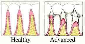 Periodontal Disease/Soft Tissue Management
